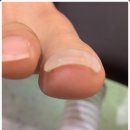 계양내성발톱 만족스러운 풋케어 베티네일