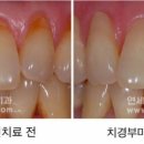 상아치과재료 이미지