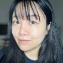 신촌역(2) | 눈밑실리프팅 눈밑꺼짐 눈밑처짐 신촌역피부과에서 받은 후기