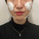 비너스의원 | 비너스 달걀주사 맛집 “샘킴의원” 내돈내산 후기