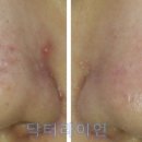 진성레이져 이미지