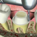 광명치과기공소 이미지