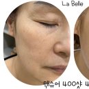 라 벨르 에스테틱 이미지