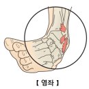 피지오스 이미지