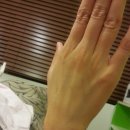 에스테틱::청주 가경동 피부관리실/ 기노/ 기노 유리알 필링/ 기노 보떼누브 트리트먼/예그리나 스킨케어
