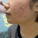 고운아이청소년과 티스토리