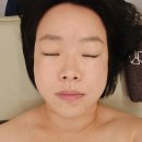롯데리아 전주에코점 | 전주 이중턱관리 4회차 후기 : 예라인에스테틱