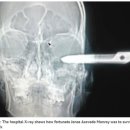 머리랑가위랑