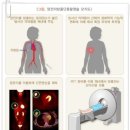 급여 양전자단층촬영(PET)검사비용지원(연간1회한) 특별약관 이미지