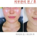 뉴진공방&솔에스테틱 경기용인점 이미지