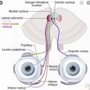 Re: Cranial Nerve III Palsy(Oculomotor nerve palsy) 이미지