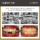 울들치과기공소 이미지