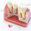 림플란트치과의원 이미지