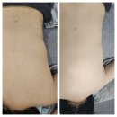 리타임뷰티 옥정점 옥정 다이어트 관리 후기