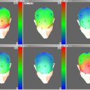 뇌파계 이미지