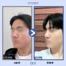 강남세련성형외과의원 이미지