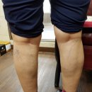 손태석 발가락운동용구 이미지