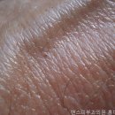 서울피부과 밴스피부과의원 마포구역 피부 고민, 여기서 해결