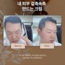 리덴컴퍼니 네이버블로그