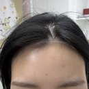 세인자연 | [인천/부평] 세인 왁싱- 헤어라인 왁싱 찐만족후기