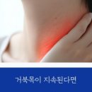 본브릿지정형외과의원 네이버블로그