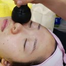 유아이성형외과의원 | 밀크필링 추천 후기 :: 대전 유아이성형외과