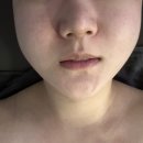 성북-길음-303 | 길음피부관리 퀸 에스테틱 윤곽후기