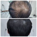 연제구-057 | 연산동 머리잘하는 곳 머리맛집에 다녀왔던 후기!