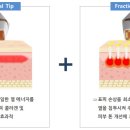 텐하이 이미지