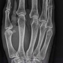 직장인퇴근길A 이미지