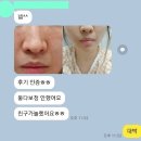 [프라이하우트 이븐앰플] 기미잡티 지우개 인증 ♥