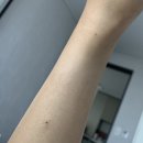 2주 간의 기록 :: 초산 유도분만 1박2일 성공 후기/저혈당, 서맥, 신생아 뇌출혈 니큐(신생아중환자실...