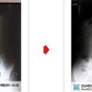 강남세란의원 이미지