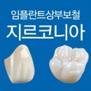 예쁜치아디자인치과기공소 이미지