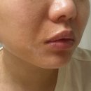 시호와 | 집에서 하는 탄력 케어, 홈쎄라 야노시호 하이푸 뷰티디바이스 후기 (10만샷 패키지)