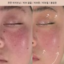 김해 리프팅탄력관리 잘하는 에스테틱 추천 백퍼센트스킨앤바디 브레핏호흡 피부관리