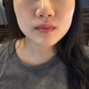 강남 물광피부 만들어주는 에이치앤비 에스테틱 솔직후기