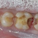 예치과기공소 이미지