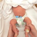 해주병원 | 생후 12주차 3개월 아주대학교 소아과 혈관종 진료 다녀온 후기