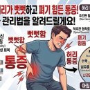 Spine disease 이미지