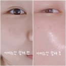 늘봄아로마테라피 | 용암동피부관리 뷰티살롱 늘봄 피부 아미노산 광채 테라피 후기