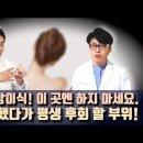 성형외과 전문의가 털어놓는 필러, 지방이식 함부로 하면 안되는 부위. 유방성형수술 할 때 꼭 알아야 할 사항들 이미지