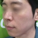세타 | 먹는 콜라겐 추천, 저분자 어린콜라겐 닥터세타 123 찐사진 후기