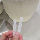 O.R 치과기공소 | [대구 메트O안과 스마일라식] 당일수술 / 방문꿀팁 / 한달차 솔직 후기 :)