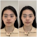 뷰티에이블 - 진주시 | 진주피부관리, 뷰티에이블 얼굴 비대칭 두골비 후기