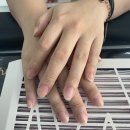 아이테오네일