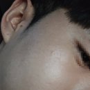 진평동 | 30대 성인 여드름 대탈출 성공! 구미 진평동 피부관리샵 오아메디스킨 후기 (내돈내산)