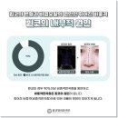 별성형외과의원 네이버블로그