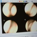 하얀마음한의원 | 환절기 알레르기비염 원인 찾아 제기동한의원에서 배농치료 한약으로 관리한 후기