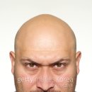 대머리 이미지